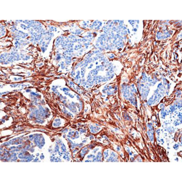 Smooth Muscle Actin (SMA)